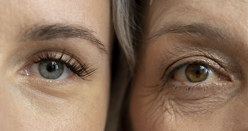 Mulher perdendo o cabelo